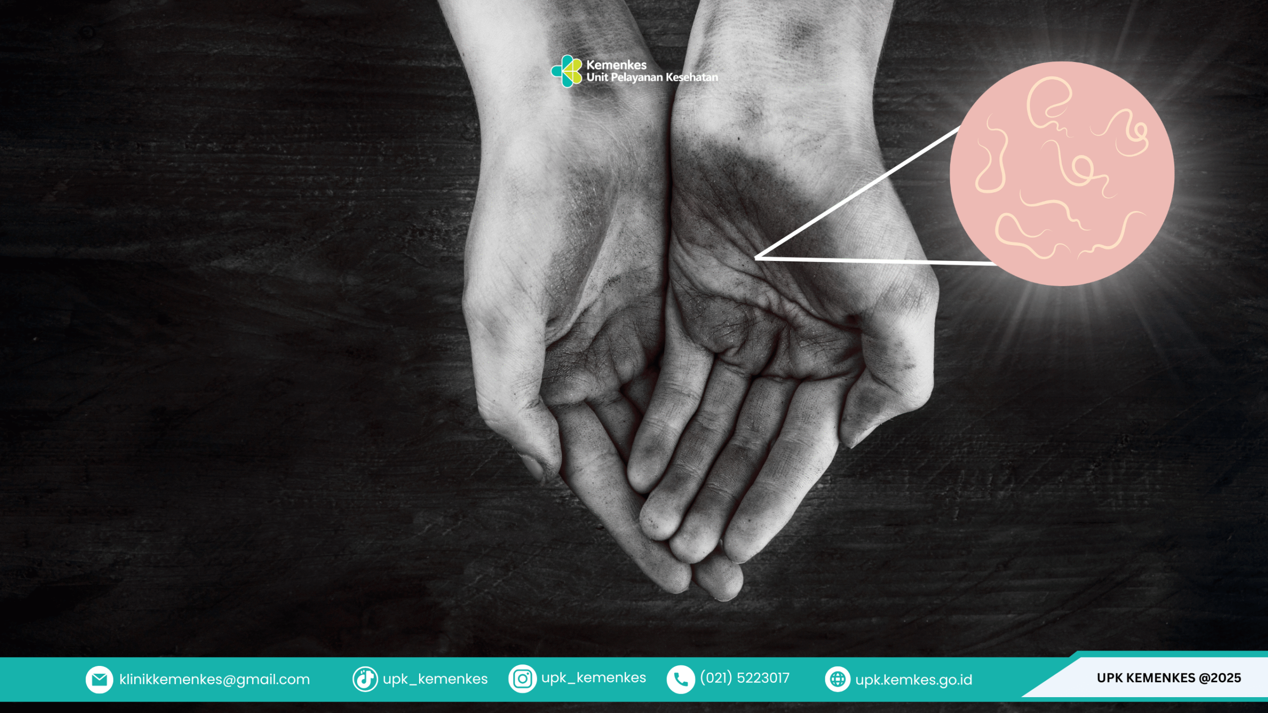 Ini Penyebab, Dampak, dan Cara Mencegahnya